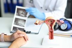 Imagen ilustrativa del artículo Sangrado vaginal: 10 causas y qué hacer