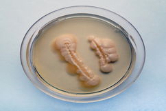 Imagen ilustrativa del artículo Candida albicans: qué es, síntomas y tratamiento