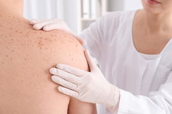 Imagem ilustrativa do artigo Herpes zóster: o que é, sintomas, causas e tratamento