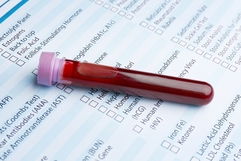 Imagen ilustrativa del artículo Prueba de GCH cuantitativa en sangre: para qué sirve y resultados